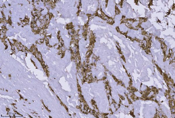 Anti-Annexin-4/ANXA4 Antibody