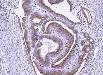 Anti-ALDH3A1 Antibody