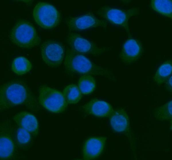 Anti-AGO1 Antibody