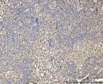 Anti-XAF1 Antibody