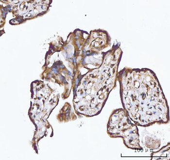 Anti-XAF1 Antibody