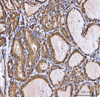 Anti-XAF1 Antibody