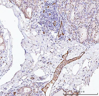 Anti-Von Willebrand Factor/VWF Antibody