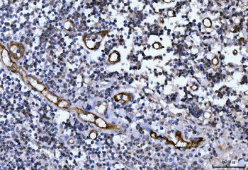 Anti-Von Willebrand Factor/VWF Antibody