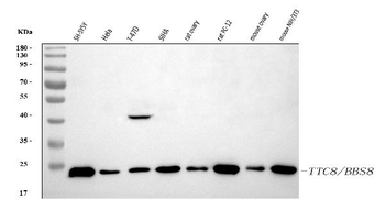 Anti-BBS8/TTC8 Antibody