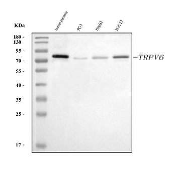 Anti-TRPV6 Antibody