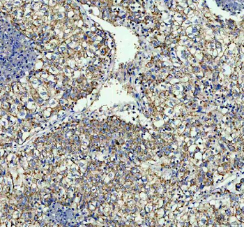 Anti-TOMM20 Antibody