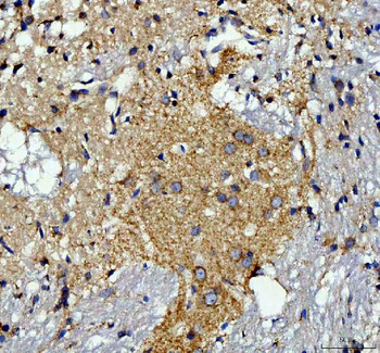Anti-TOMM20 Antibody