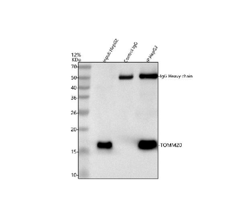 Anti-TOMM20 Antibody
