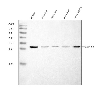 Anti-SNAIL/SNAI1 Antibody