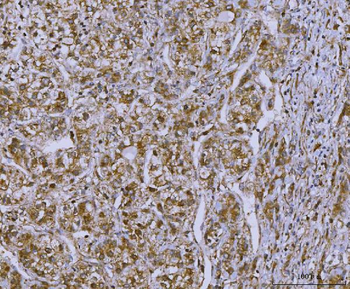 Anti-OAT2/SLC22A7 Antibody