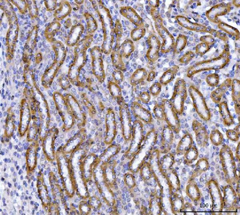 Anti-OAT2/SLC22A7 Antibody