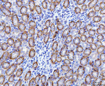Anti-OAT2/SLC22A7 Antibody