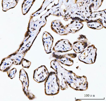 Anti-RING2/RING1B/RNF2 Antibody