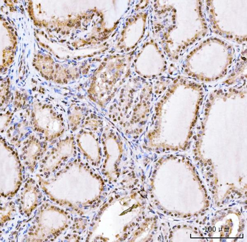 Anti-RING2/RING1B/RNF2 Antibody