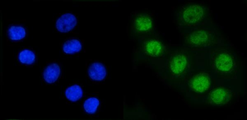 Anti-RAD21 Antibody