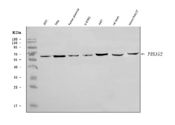 Anti-PRKAG2 Antibody