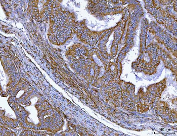 Anti-MIM/MTSS1 Antibody