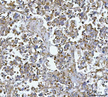 Anti-MIM/MTSS1 Antibody
