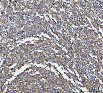 Anti-MIM/MTSS1 Antibody