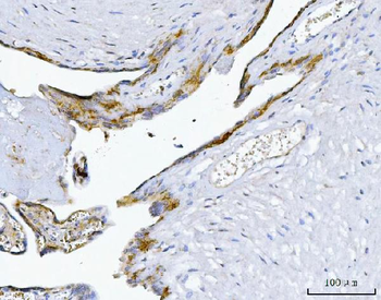 Anti-MIM/MTSS1 Antibody
