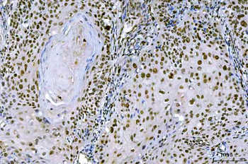 Anti-Ki67/MKI67 Antibody