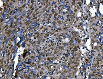 Anti-Ki67/MKI67 Antibody