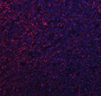 Anti-MFF Antibody