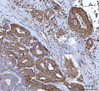 Anti-MFF Antibody
