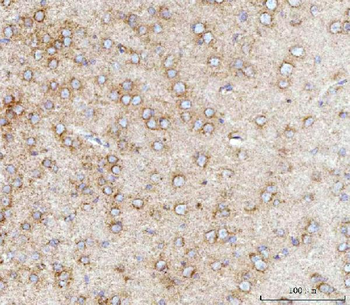 Anti-MFF Antibody