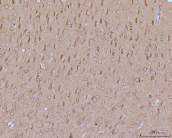 Anti-MFF Antibody