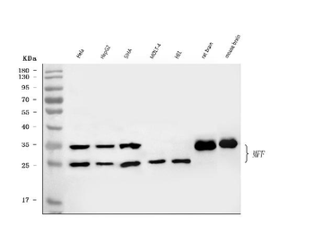 Anti-MFF Antibody