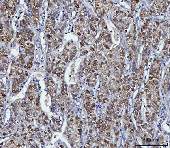 Anti-KMO Antibody