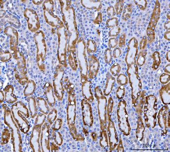 Anti-KMO Antibody