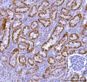 Anti-KMO Antibody