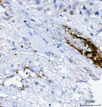 Anti-Integrin beta 3/ITGB3 Antibody