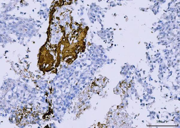 Integrin beta 3/ITGB3 Antibody