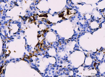 Anti-Integrin beta 3/ITGB3 Antibody
