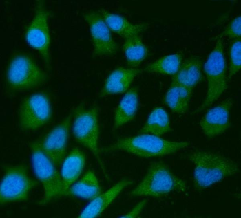 Anti-IRS2 Antibody