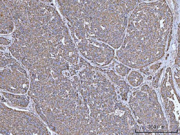 Anti-IRS2 Antibody