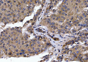 Anti-GOLGA3 Antibody