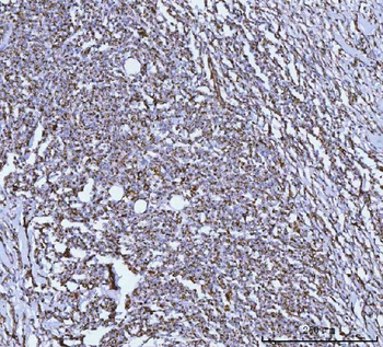 Anti-GLUD1/2 Antibody