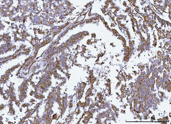 Anti-GLUD1/2 Antibody