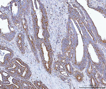 Anti-GLUD1/2 Antibody