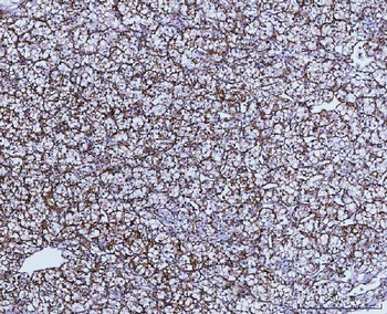 Anti-GLUD1/2 Antibody