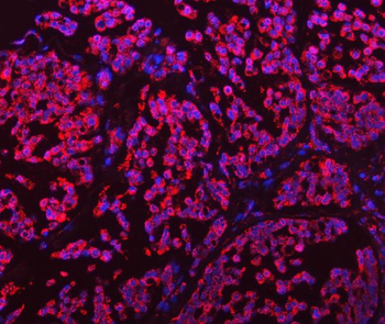 Anti-GLUD1/2 Antibody