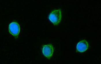 Anti-GLUD1/2 Antibody