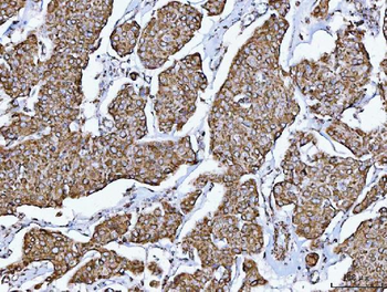 Anti-GLUD1/2 Antibody