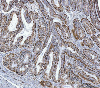 Anti-GLUD1/2 Antibody