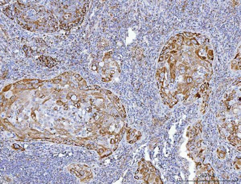 Anti-GLUD1/2 Antibody